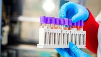 Photo of Бас санитар 11 мамырдан кейінгі режимді бекітті