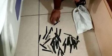 Үндістанда дәрігер пациенттің қарнынан 13 қасықты алып шықты